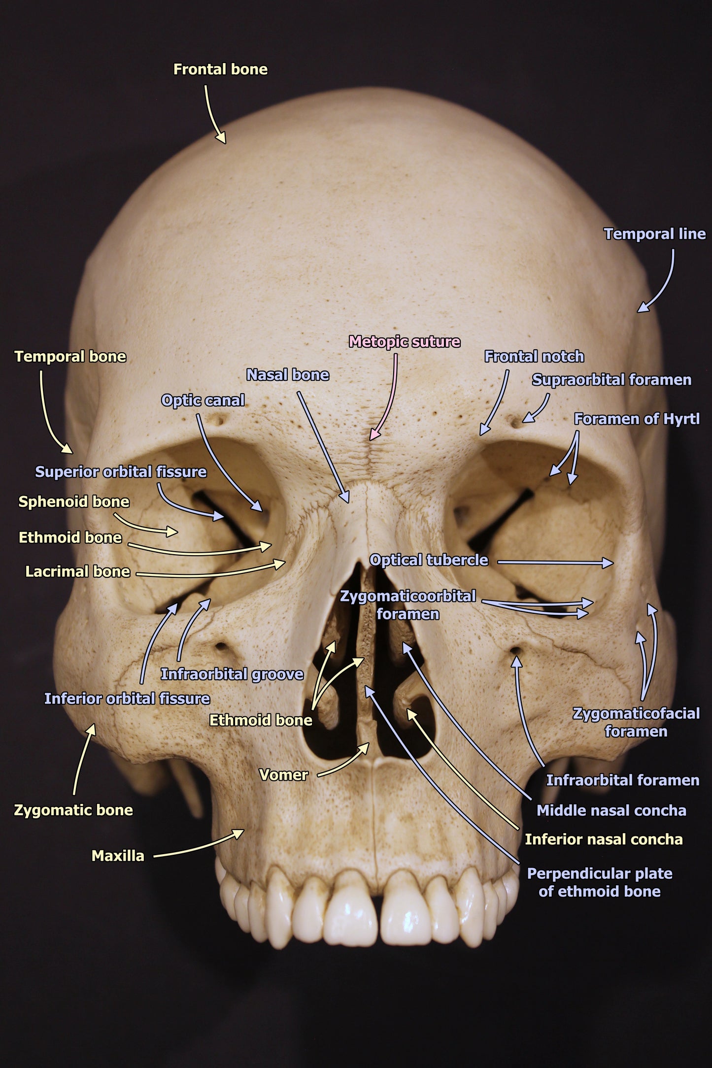 Arnold Skull