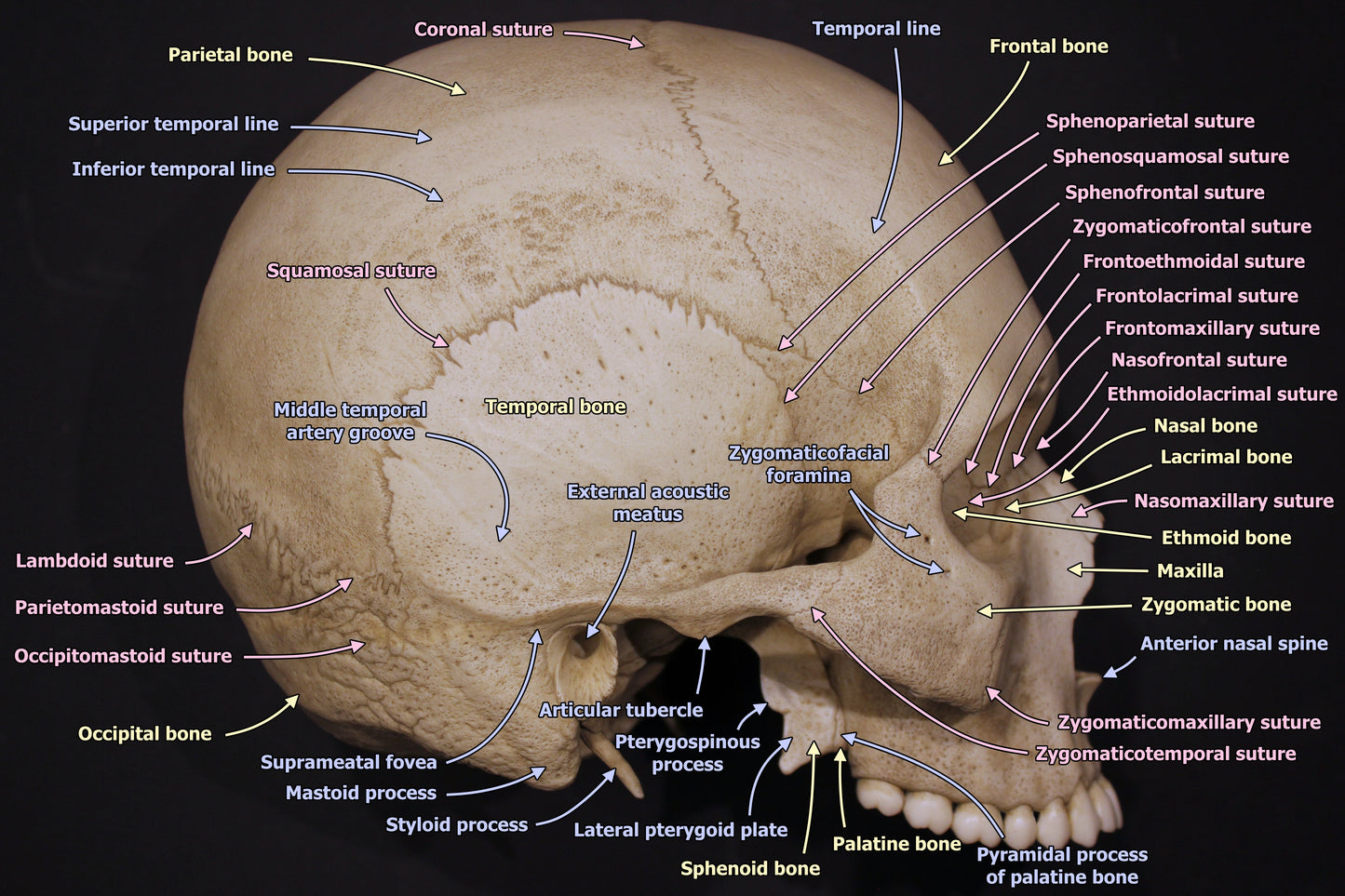 Arnold Skull